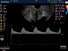 аппарат узи портативная ультразвуковая диагностическая система sonoscape s9 pro